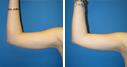 Before & After Photos